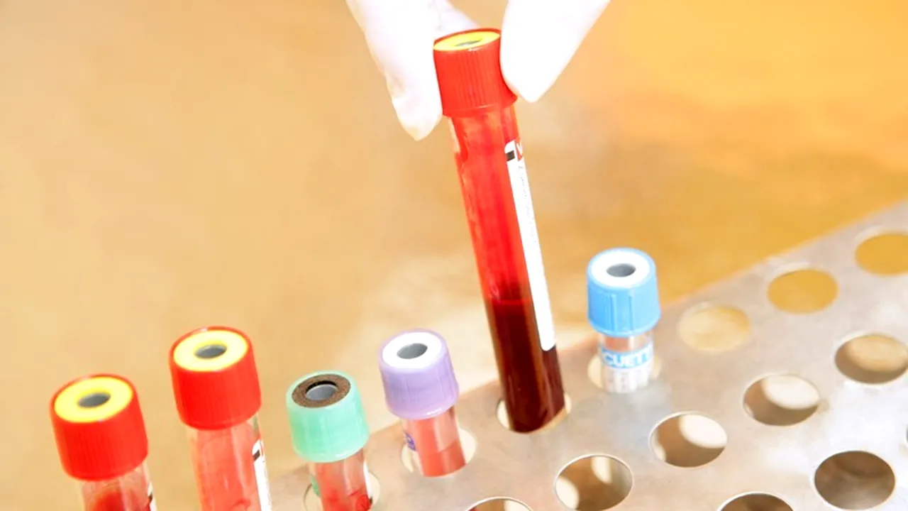 STUDIU. Peste cinci ani, cancerul ar putea deveni o boală tratabilă