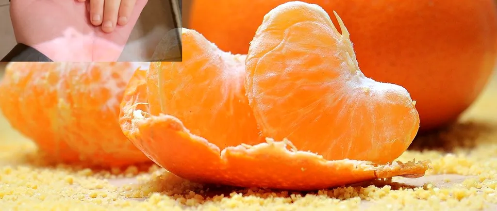Mama unui copil a fost șocată să vadă ce a pățit fiul său: A devenit portocaliu după ce a mâncat prea multe portocale și mandarine. Ce spun medicii
