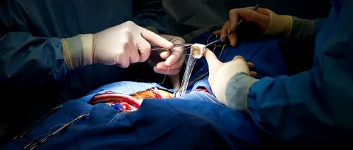 Un chirurg de top din Marea Britanie și-a INSCRIPȚIONAT inițialele pe ficatul unui pacient. Cum a justificat gestul