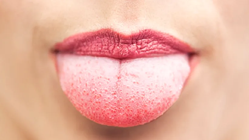„Dacă observați asta pe limba dumneavoastră, mergeți imediat la medic! Avertisment: cum trădează limba o boală mai gravă 