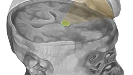 Metoda revoluționară care „restartează