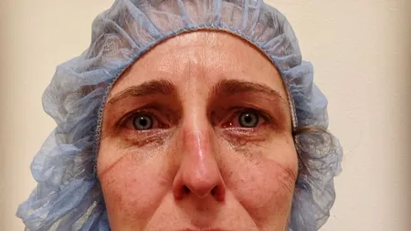 Mărturia unei asistente din SUA, în plină pandemie: „L-am pus într-un sac, lux acordat doar celor care reuşesc să iasă de la urgenţă. Jos, cadavrele se adună pe tărgi“