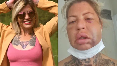 Coșmarul lui Vicky din Nottingham. Cu ce ZÂMBET te poți pricopsi cu doar 10.000 de lire sterline