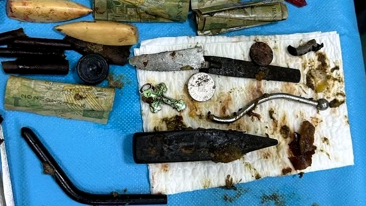 Caz șocant la IAȘI. Medicii au găsit în stomacul unui bărbat un ciocan, lame de cuțit și alte obiecte