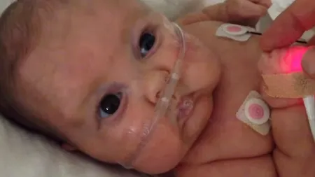 Gestul emoționant pe care un tatăl l-a făcut pentru fiul lui născut prematur