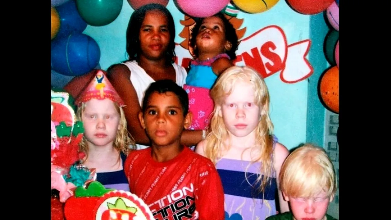 Deși par total diferiți, copiii din imagine sunt frați. Reacția mamei: 