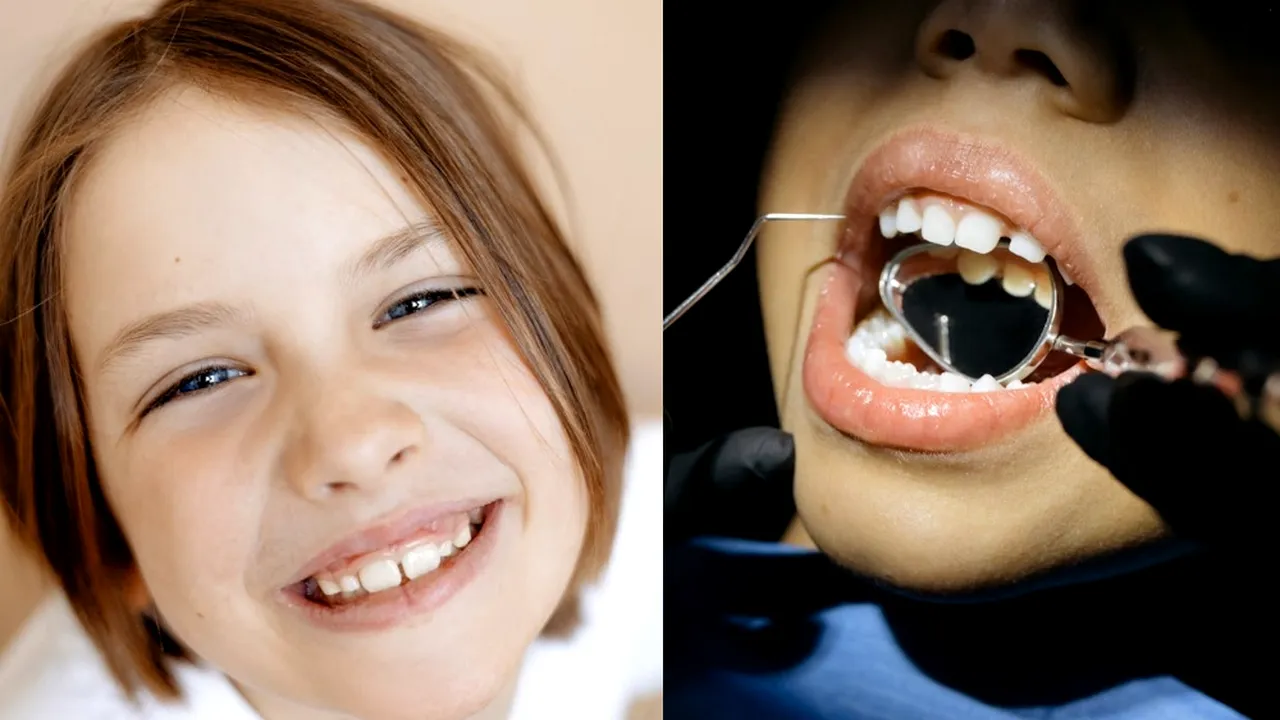 Ce s-a întâmplat cu dinții copiilor, după ce fluorul a fost îndepărtat din apă