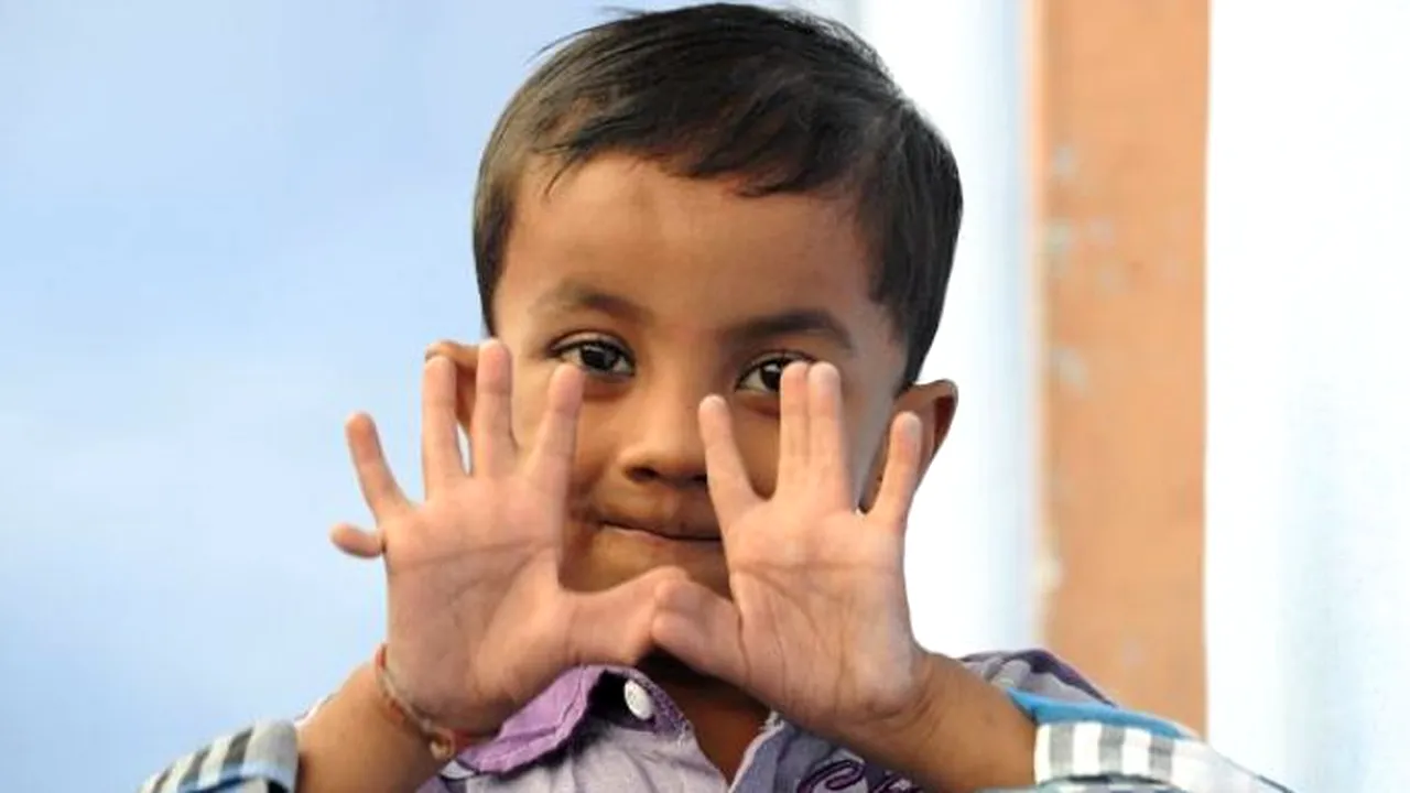 Băiatul cu 25 DE DEGETE. Motivul pentru care părinții nu vor să îl opereze