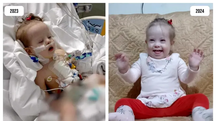 Măriuța avea două găuri în inimă. La un an de la operație, copila din Bucovina este PERFECTĂ!