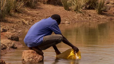 Ce au găsit medicii australieni în piciorul unui imigrant sudanez 