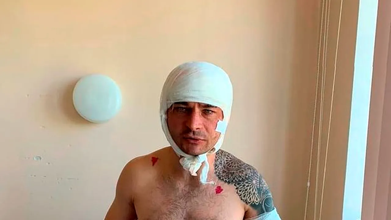 Pescar scalpat de un urs pe Insula Sahalin. Bărbatul a făcut pe „mortul” și apoi a condus șase kilometri până la spital