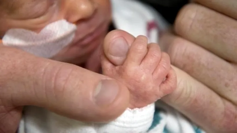 Șanse de 1 la 100 de milioane: nașterea care a impresionat o țară întreagă. VIDEO