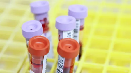 Bilanț Covid în România, 27 august 2021. Peste 900 de cazuri noi de coronavirus. Creşte numărul internărilor la ATI