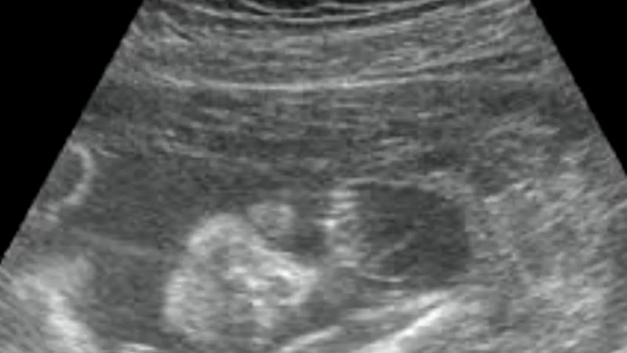 O astfel de mamă la 200 de milioane. 