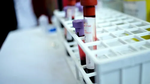 Premieră mondială. Cercetătorii clujeni au creat sânge artificial și sânge incolor