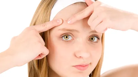 Ce sunt punctele albe care apar pe față