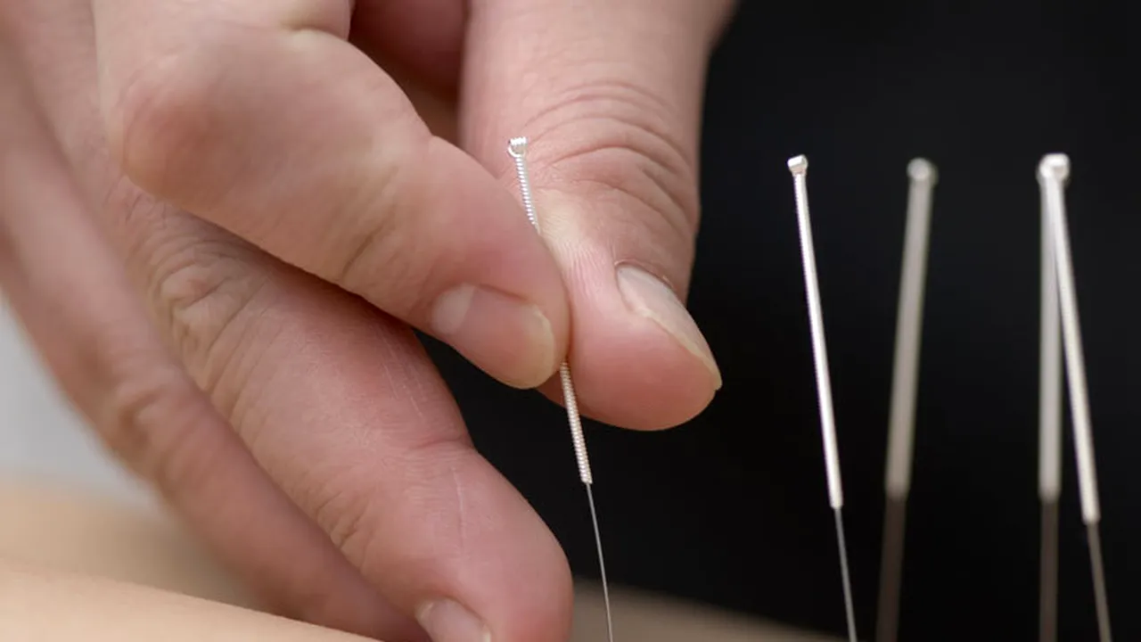STUDIU. Acupunctura ar putea ajuta la tratarea Parkinson-ului