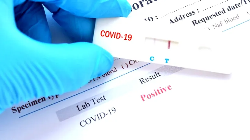 Testele rapide pentru coronavirus, aflate în România, nu sunt de încredere. Anunțul făcut de un cunoscut medic: “S-au folosit mult, fără să aibă relevanță!”