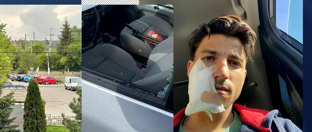 Un tânăr din Câmpina, MUTILAT în parcare. Agresorul i-a spart geamul mașinii cu o sticlă de bere și a fugit. ”Am văzut cioburi și cum sărea sângele”