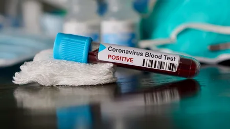 Un italian a murit din cauza Covid-19, după ce a participat la o petrecere organizată special pentru ca oamenii să se infecteze cu noul coronavirus