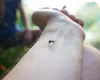 Ce să nu folosești niciodată în casă pentru a omorî insecte. Dr. Radu Țincu avertizează: „Am avut pacienți care au murit după expunere”