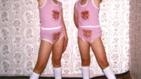 Aceste gemene au cheltuit 100.000 de euro ca să nu poată fi deosebite. Cum arată la 38 de ani