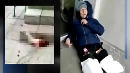 VIDEO | O femeie a rămas fără picioare din cauza unei rachete rusești. Atenție, IMAGINI ȘOCANTE din Harkov!