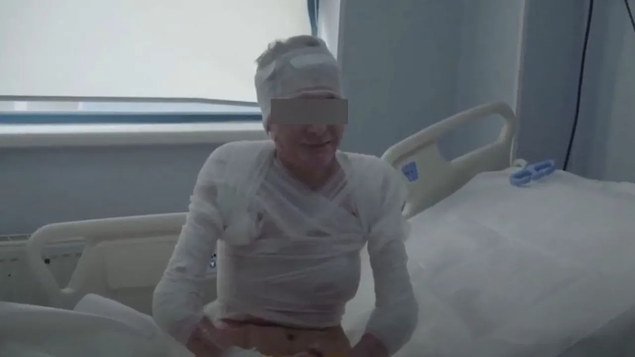 Mărturia cutremurătoare a tinerei incendiate de criminalul din Mehedinți: „Vă rog să mă ajutați să devin din nou un om normal” (VIDEO)