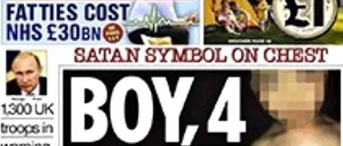 Tabloidele britanice lovesc din nou: „Un băiețel de 4 ani are semnul Diavolului. Cât de mult e prea mult?
