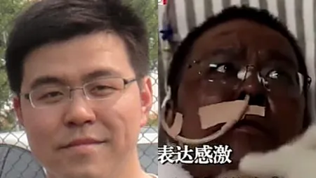 ȘOCANT. Unul dintre doctorii a cărui piele s-a înnegrit din cauza tratamentului pentru coronavirus a murit după ce s-a luptat 5 luni cu boala! - FOTO