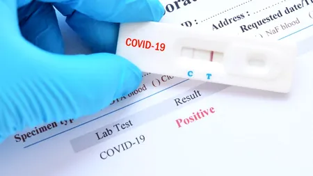 Ce categorii de persoane sunt exceptate de la testarea anti-COVID. INSP, anunț de ultimă oră