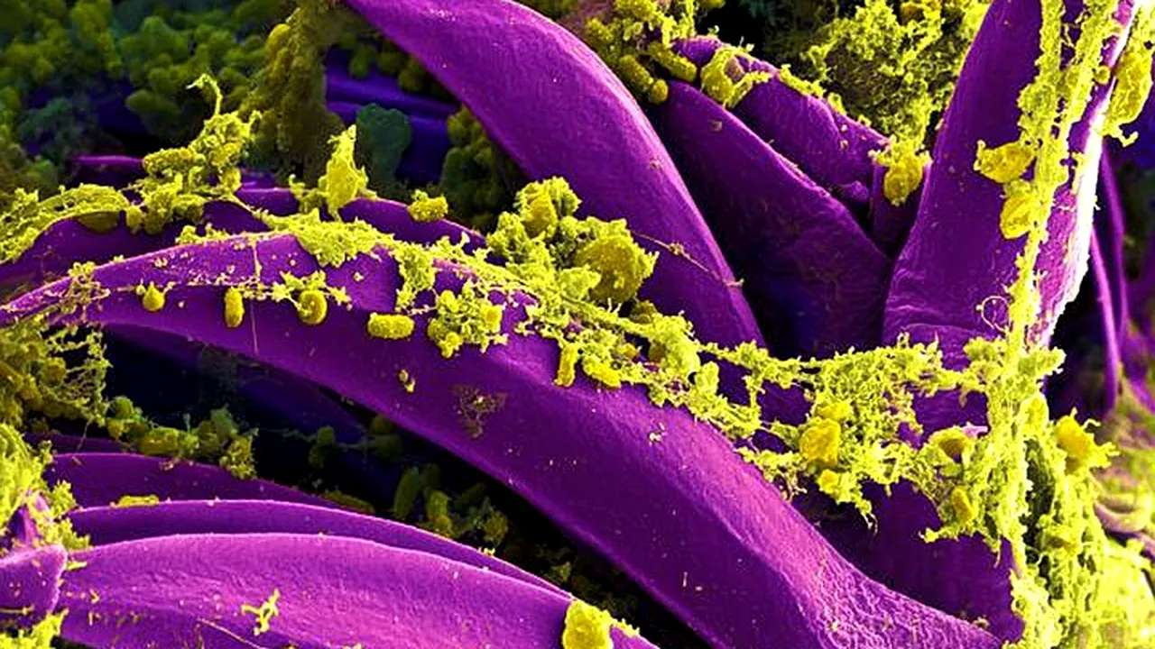 Ucigașii viitorului. Cum vor ajunge infecțiile prima cauză a mortalității