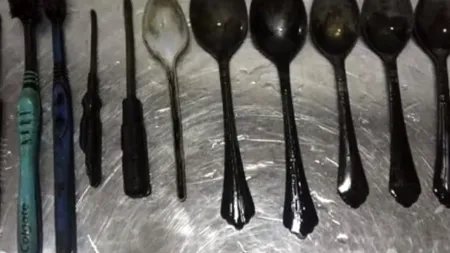 Caz medical șocant: Avea o durere de stomac, însă ce au descoperit medicii în interior pare aproape imposibil - VIDEO