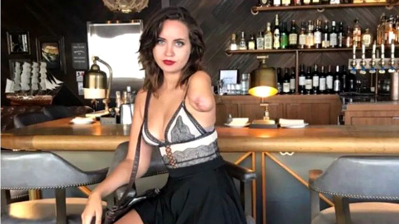 Un accident stupid i-a schimbat viața pentru totdeauna. Modul în care își celebrează acum dizabilitatea este o adevărată lecție de optimism