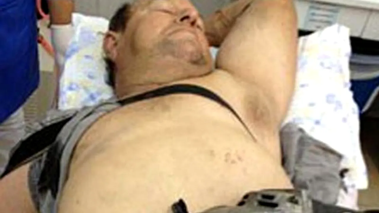 A scăpat cu viață după ce i-a intrat flexul în burtă