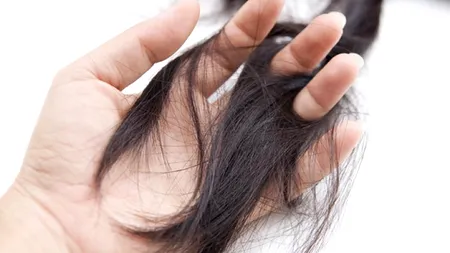 Copilă de 11 ani cu sindromul ”Rapunzel”, operată de urgență, după ce și-a ÎNGHIȚIT propriul păr! Chirurgii au scos un smoc uriaș din stomacul fetei