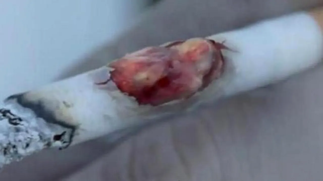 Ce efect are fumatul asupra pielii. GALERIE FOTO 