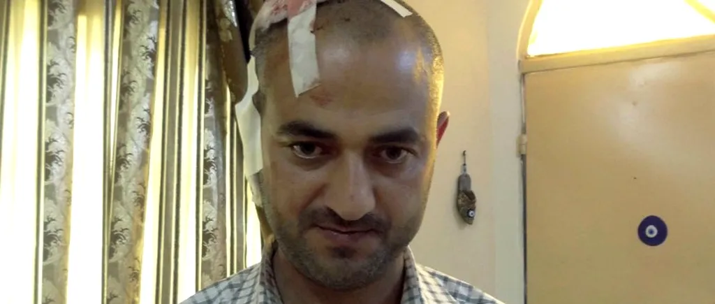 Un reporter AFP a fost rănit grav în Irak, în timpul ultimelor atentate cu mașini-capcană