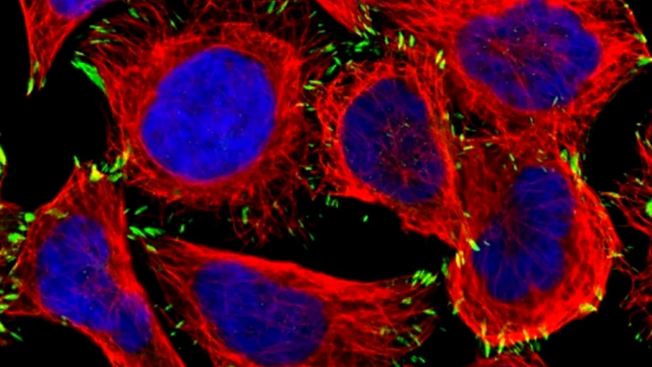 Descoperire crucială: Cancerul care omoară cei mai mulți oameni este, de fapt, un conglomerat din patru boli distincte