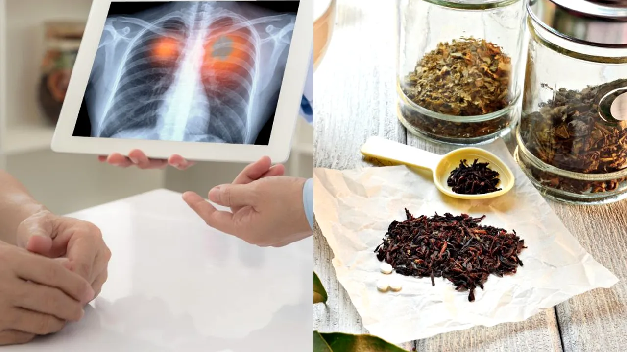 10 remedii împotriva cancerului intens vehiculate pe internet, puse sub lupa medicului oncolog