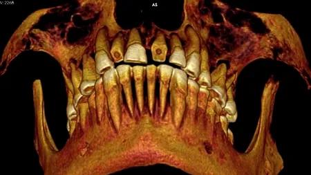 DESCOPERIREA care dezvăluie în premieră o PRACTICĂ MEDICALĂ din Egiptul antic
