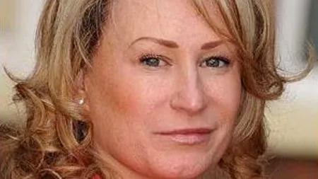 Ce a pățit o femeie din Marea Britanie care a abuzat de tratamentele de înfrumusețare. „Voiam să arăt  bine, dar m-am trezit în agonie