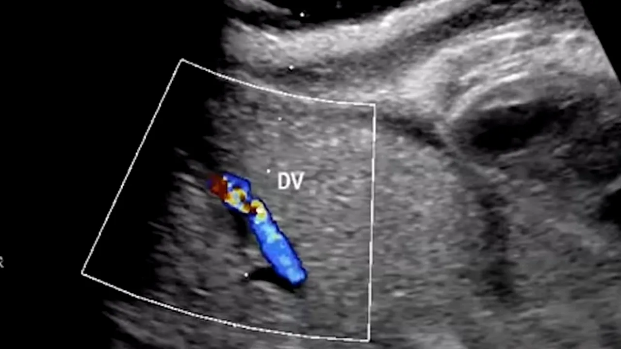 A fost inventat „uterul artificial