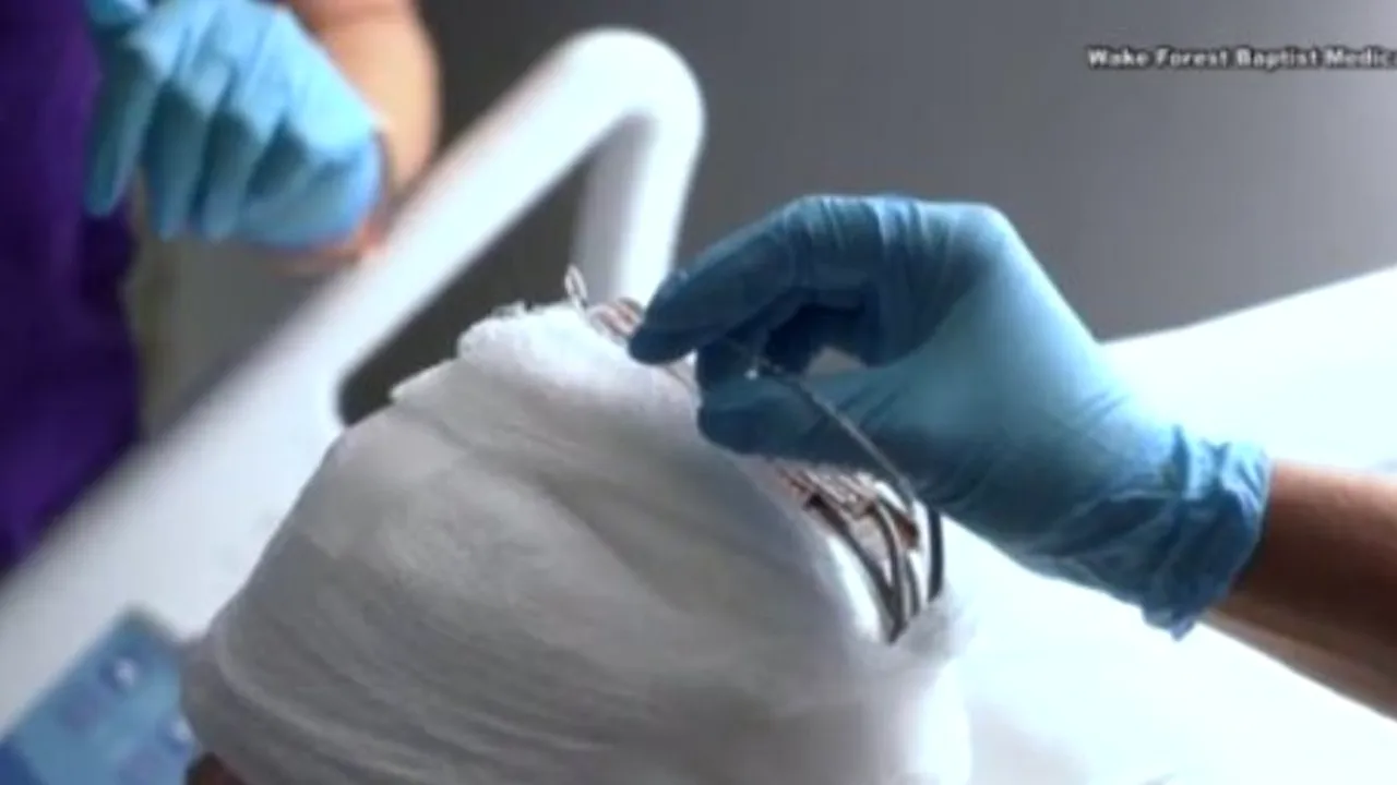 Inovație în lumea medicinei. Descoperirea care poate face ca amintirile unei persoane să poată fi „recuperate