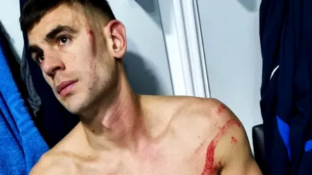 Edjouma, FAULT horror asupra lui Igor Armaş: „Putea să mă desfigureze!”. Jucătorul de la FCSB a scăpat de eliminare