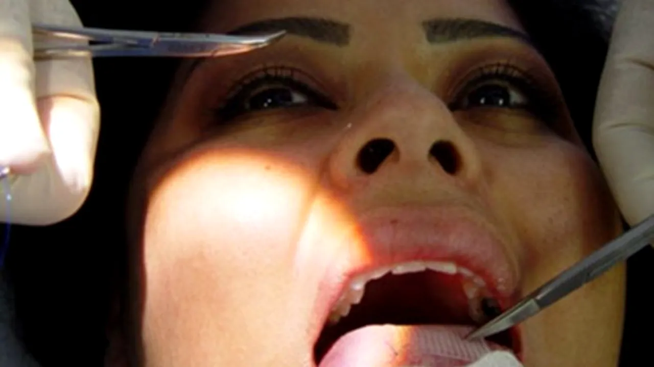 CURĂ DE SLĂBIRE sau tortură? Plasturele care te-ar scăpa de kilogramele nedorite