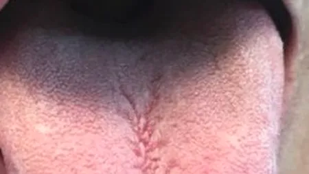 „Mi-au dispărut papilele gustative. Nu mai simt nimic