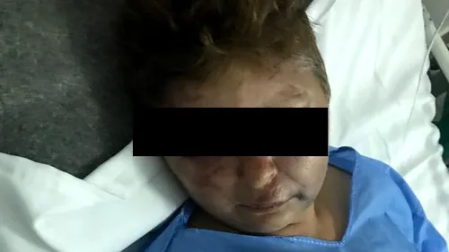 Polițist acuzat că a desfigurat o femeie în județul Olt. Victima: „A vrut relații cu mine... Mi-a dat cu picioarele, cu vătraiul