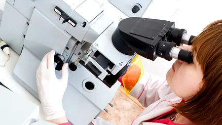 STUDIU. Un test de sânge poate detecta riscul de recidivă a cancerului mamar 
