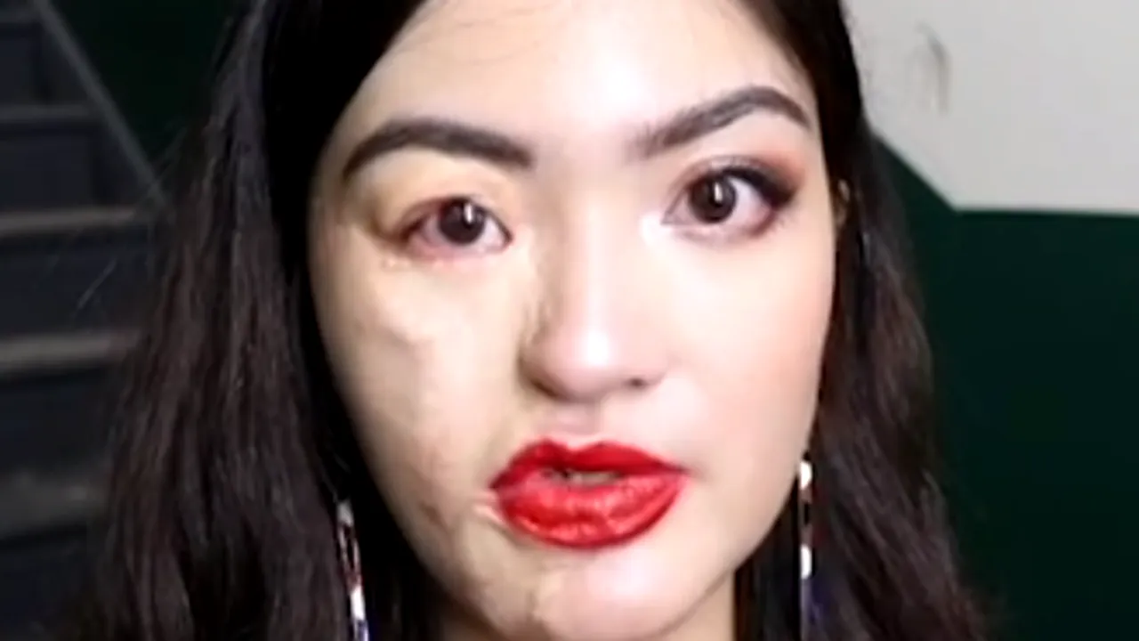 O tânără care a suferit un accident cumplit în copilărie își transformă cicatricile în ARTĂ - FOTO